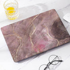 Urban beauty | Macbook case customizable